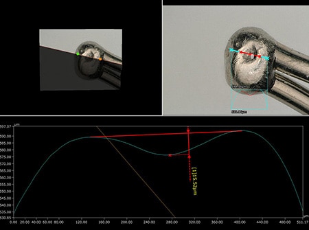 Profile measurement of a solder defect on an electrode using the VHX Series 4K Digital Microscope