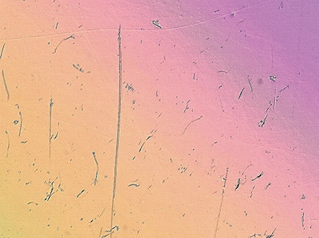 Differential interference contrast (DIC) image (400x)